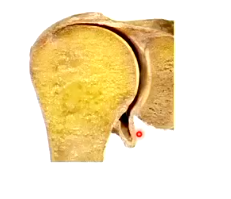 <ul><li><p>triaxial</p></li><li><p>ball and socket</p></li><li><p>incongruent tissues - the articular surfaces don’t fit ell together</p></li><li><p>large humeral head + shallow glenoid fossa</p></li><li><p>loose joint capsule = unstable joint (loose bit toards the bottom extends hen you reach out to the side)</p></li></ul><p></p>