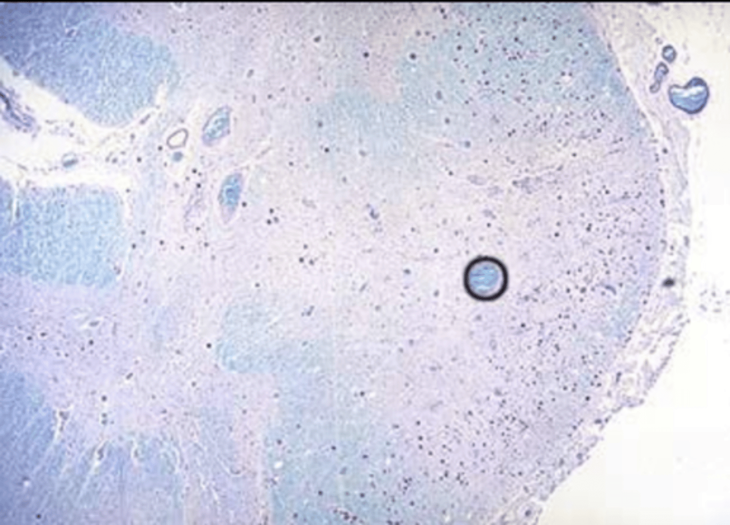 <p>myelin</p>