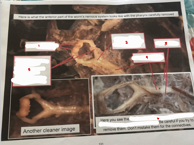 <p>Earthworm Nervous System</p>