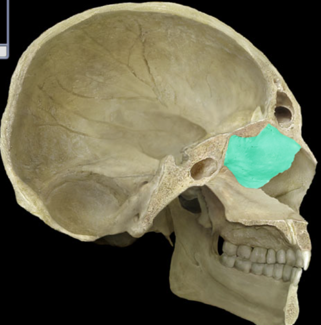 term image