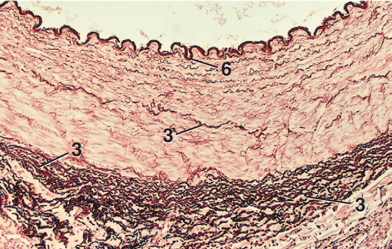 <p>Part and Stain?</p>