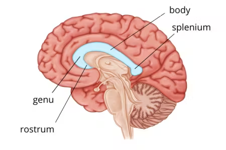 <p>middle part of corpus callosum</p>