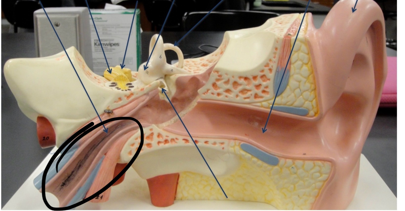 <p>Identify the circled area?</p>