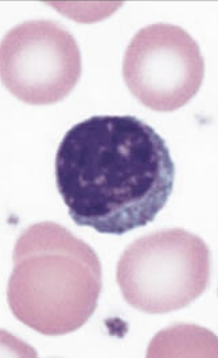 <p>How to identify lymphocytes?</p>