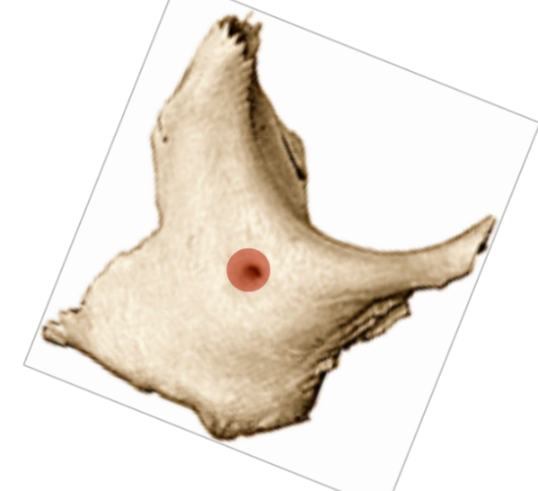 term image