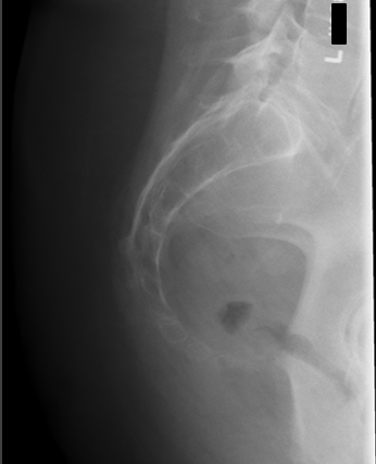 <p>critique for sacrum lateral </p>
