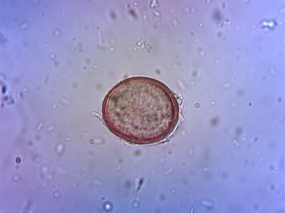 <ul><li><p>Thick protein coat and a dark centre </p></li><li><p>Treatment is usually with fenbendazole, pyrantel, selamectin, ivermectin </p></li><li><p>Once clinical signs appear as a result of VLM, euthanasia is recommended </p></li></ul><p></p>