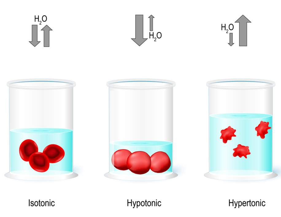 <ul><li><p>Higher solute outside</p></li><li><p>Higher water inside</p></li><li><p>Water moves out</p></li><li><p>Cell SHRINKS</p></li></ul><p></p>