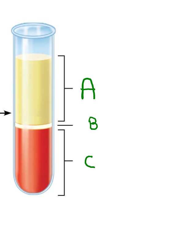 <p><span>Many choice: In what part of blood do you find cells that defend against infection?&nbsp;</span></p>