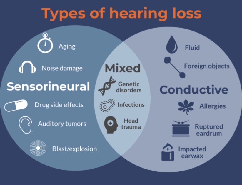<p><span>•Damage to the </span><em><span>sensory</span></em><span> or </span><em><span>neural</span></em><span>components of the inner ear (cochlea)</span></p>