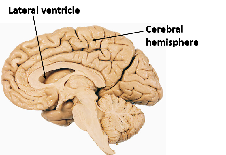 <p>Lateral Ventricles</p>