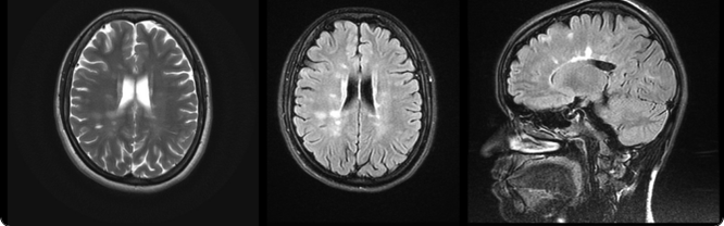 <p>Which is which </p>