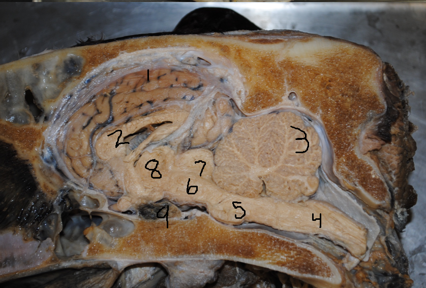 <p>What does the medulla do and what are the three parts? </p>