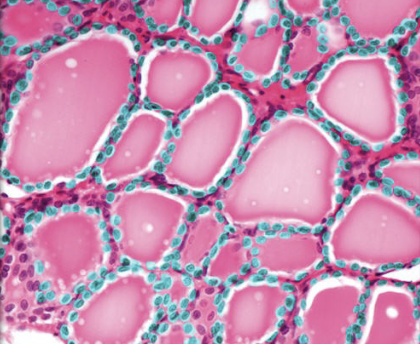 <p>what part of thyroid histology is shown?</p>