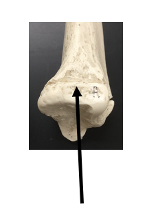 <p>What bone and bone feature is this?</p>