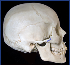 <p>What type of suture is shown?</p>