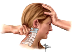 <p>Examination techniques concussion: Sharp-Purser test</p>