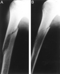 <p>fx follows a helical line</p>