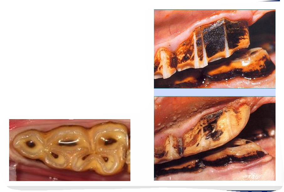 <ul><li><p>Rostral profiling (to prevent bit impingement but misconception —> bit should not sit in this location)</p></li><li><p>CONTRAINDICATED —> extra pulp horn on 06s</p><ul><li><p>pulp horn exposure</p></li><li><p>apical infection (18months)</p></li></ul></li></ul><p></p>