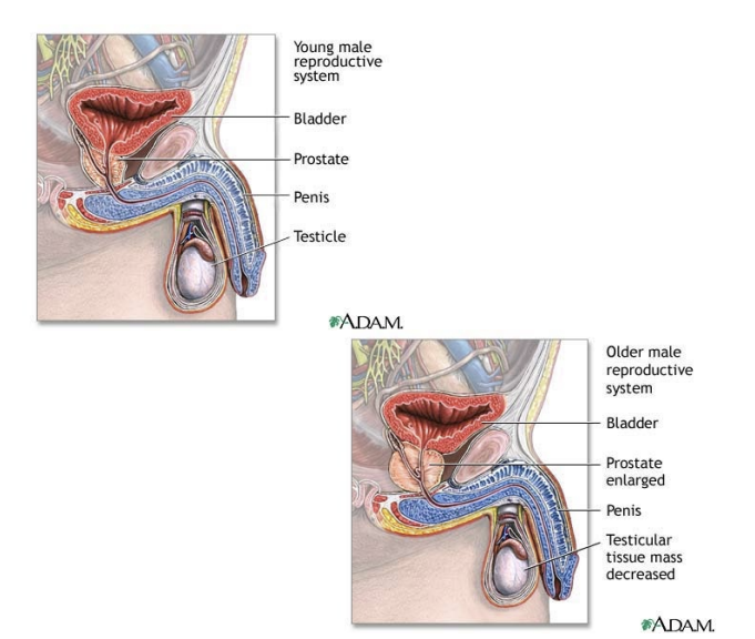 <ul><li><p>gradual decline</p><ul><li><p>Decreased testosterone</p></li><li><p>Benign prostatic enlargement – blockage of prostatic urethra</p></li><li><p>Frequency of prostrate cancer increases</p></li><li><p>Erectile dysfunction</p></li></ul></li></ul><p></p>