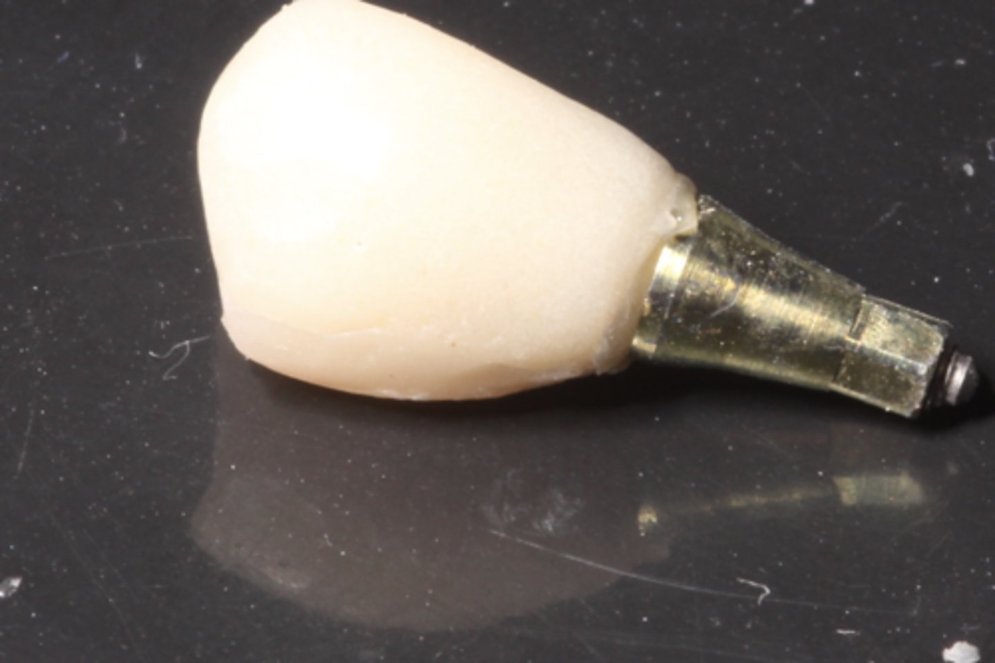 <p>Describe this abutment.</p>