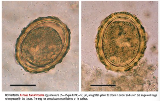 <p>often released as unicellular embryos although they are fertilized</p><p>have a thick chitin shell that protects them from the environment</p><p>have a heavy, albuminous coating that is characterized as ‘mammilated’</p><p>has small protrusions on its surface</p>
