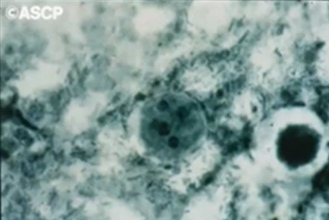 <p><span style="background-color: rgba(0, 0, 0, 0); line-height: 19.7625px;">What is the species in this photo and WHY?</span></p>