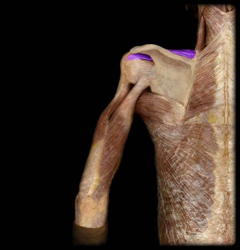<p>Name the muscle</p>