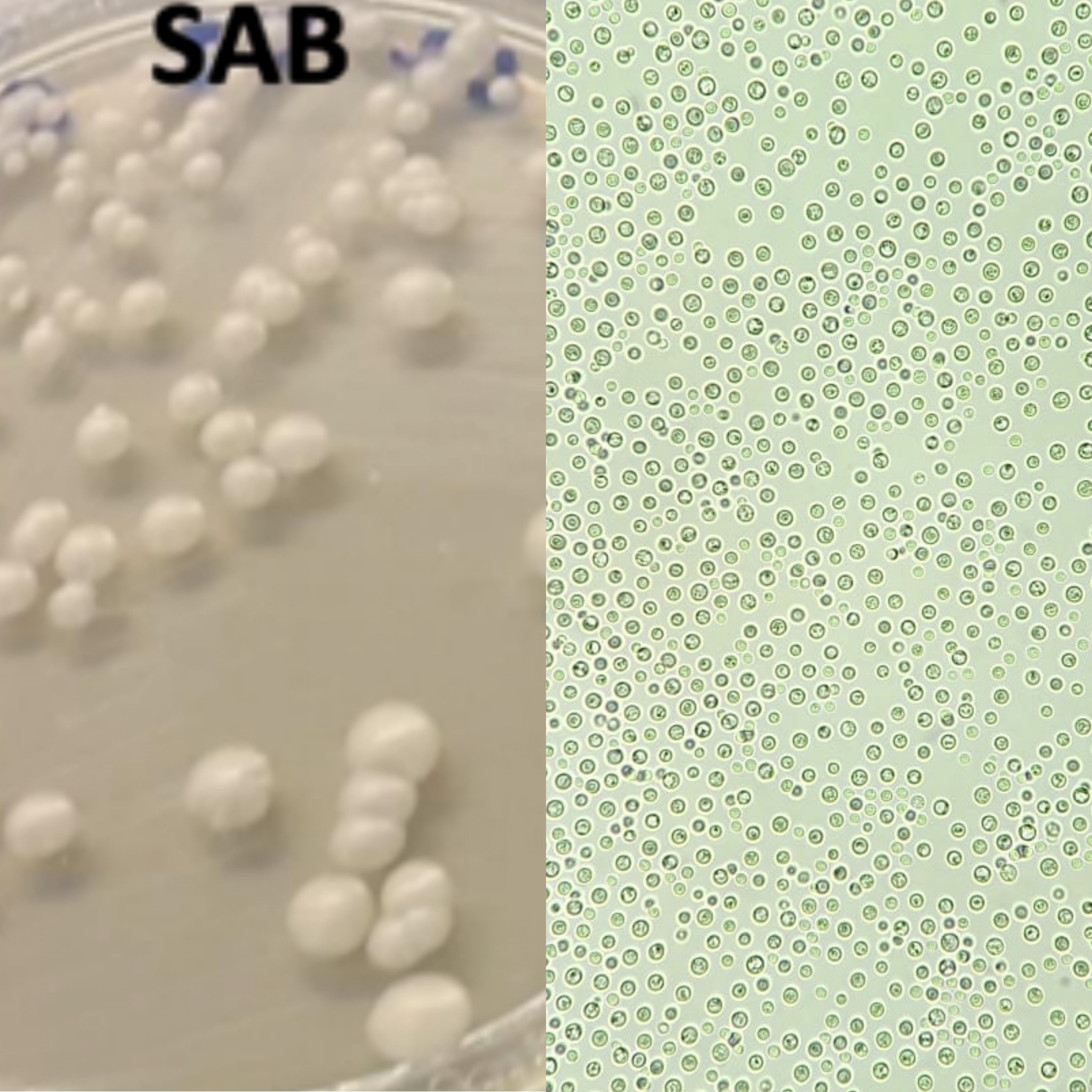 <p>Identifica a levedura pelos resultados nas provas de identificação:</p><p class="has-focus">Prova dos clamidosporos: -</p><p class="has-focus">Prova da filamentaçao: -</p><p class="has-focus">Prova dos ascosporos: +</p><p class="has-focus">Prova da urease: -</p><p class="has-focus">Prova da fenoloxidase: -</p><p class="has-focus">Sensibilidade à cicloheximida: -</p><p class="has-focus">Cor no meio de chromagar Cândida: rosa acinzentado</p><p class="has-focus">Análise macroscopica: colónias brancas creme cónicas, com bordos regulares</p>
