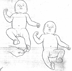 <p>28 weeks gestation</p>