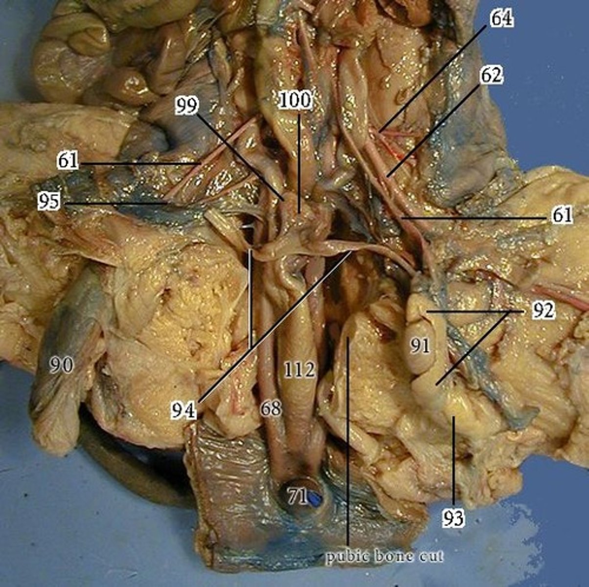 <p>91 = ?</p>