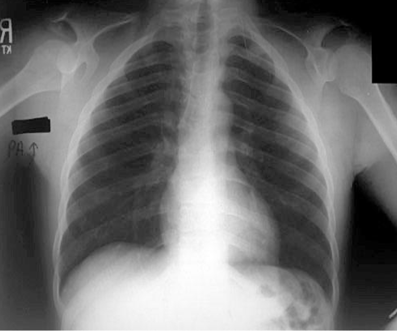 <p>What is the most clinically significant Dx</p>