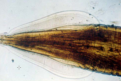 <p>Identify the parasite, it is commonly found in the stomach contents of small animals.</p>