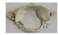 <p>what is marked? (not the star)</p>