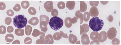 <p>Bi-lobed dark purple nucleus with dark purple granules in cytoplasm.</p><p>Dark staining, grainy nucleus (lots of visible granules). Multilobed nucleus, can be difficult to see because of granules. </p><p>Granulocytes. </p><p>0-1% frequency in the blood</p>