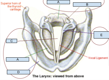 <p>Which structure is labeled D?</p>