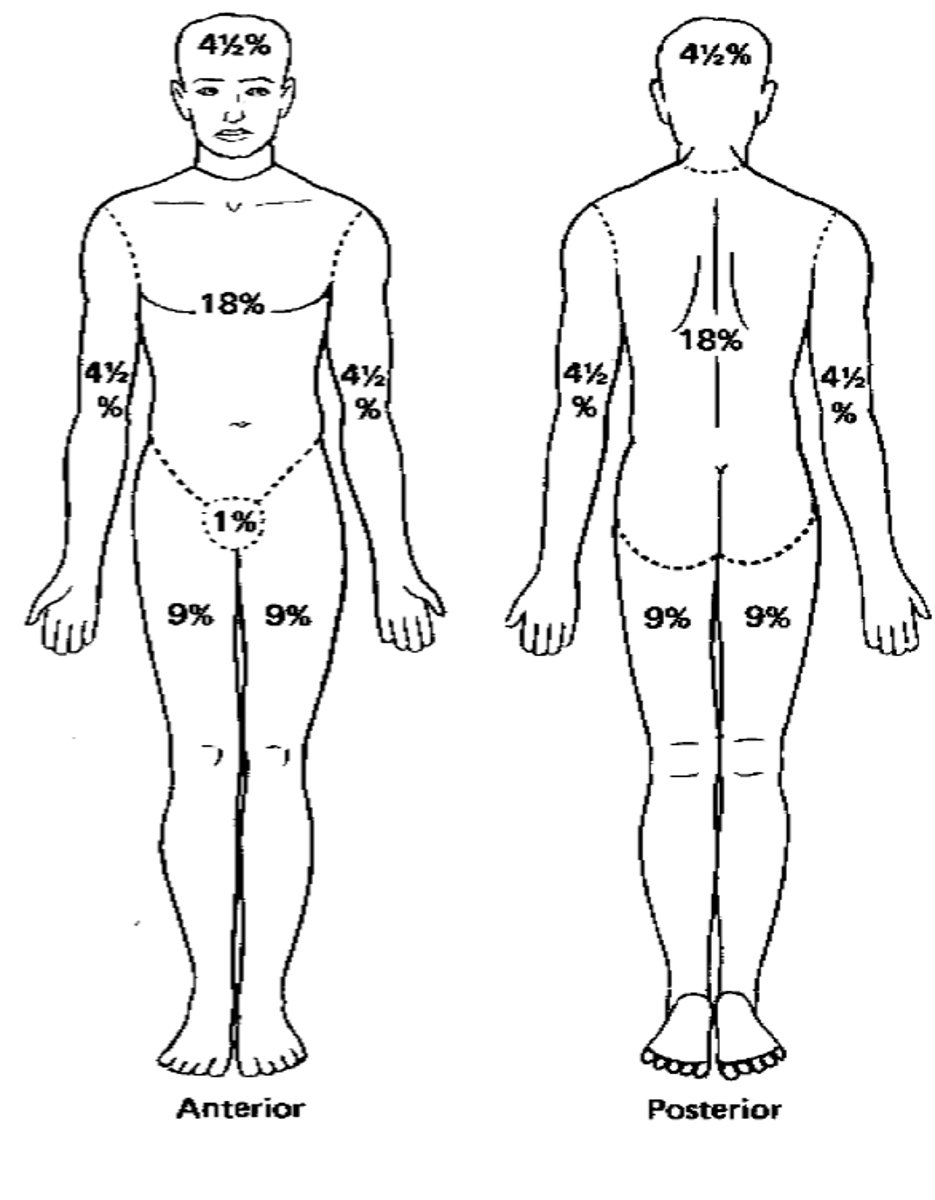 <p>- (Percentage of 2nd & 3rd degree burns) x (body weight in kg) x 4 mL in the first 24hrs</p><p>- 1/2 in 1st 8 hours</p><p>- 1/4 in 2nd 8 hours</p><p>- 1/4 during 3rd 8 hours</p>