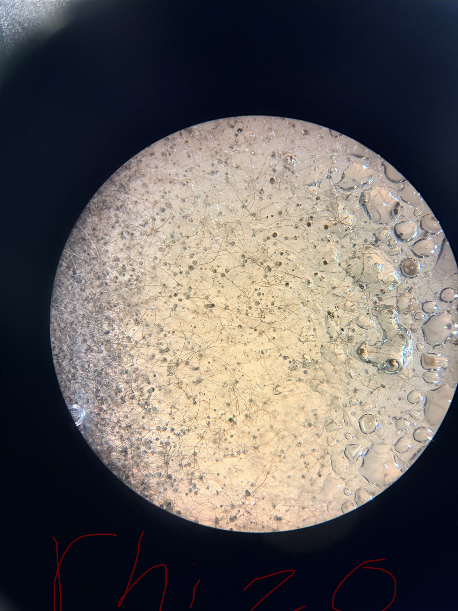 <p>*What fungus is this</p>