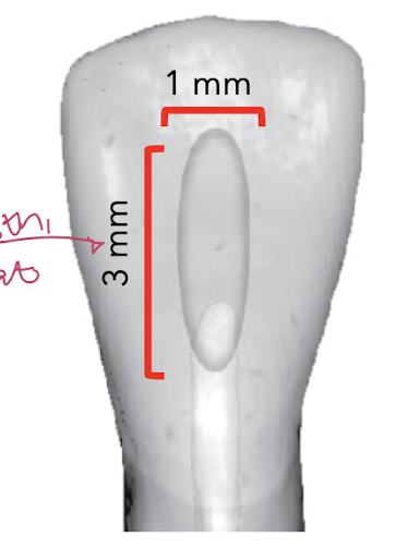 <ul><li><p>height: 3 mm </p></li><li><p>length 1 mm </p></li></ul><p></p>