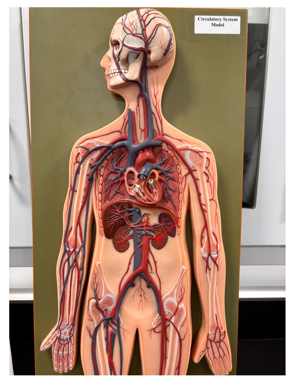 <p>name the blood vessel</p>