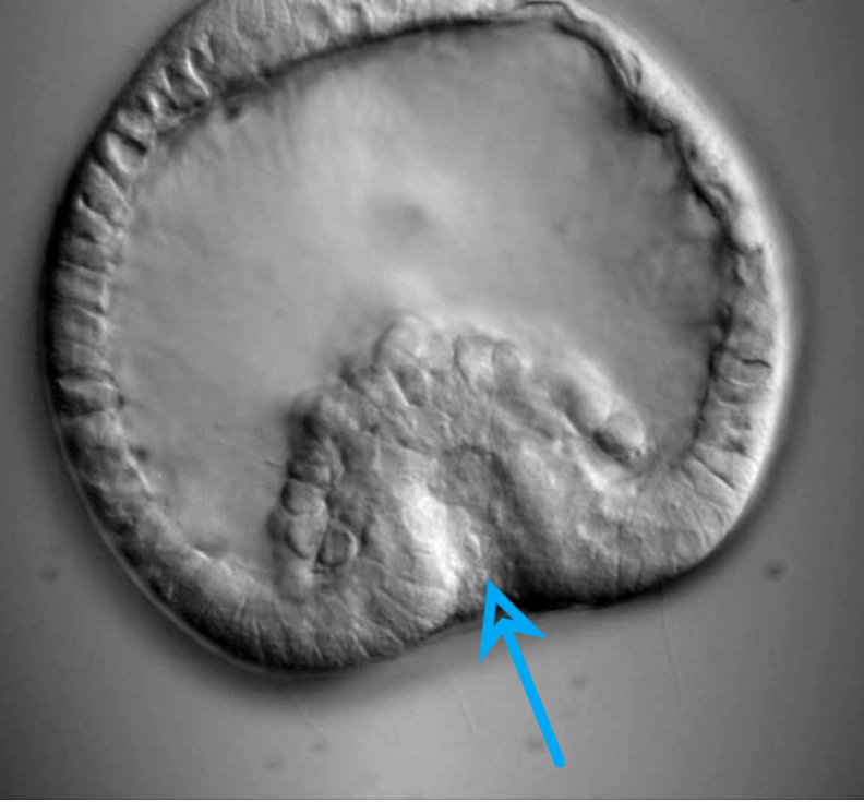 <p><span>The picture below is a sea urchin at the beginning of the gastrula phase.&nbsp; Identify the structure indicated by the arrow.</span></p>