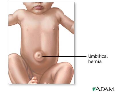 <p>navel, belly button</p>