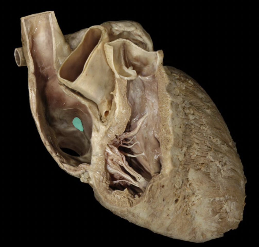 <p>Identify the feature of the right atrium</p>