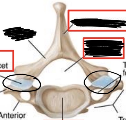 <p>What is this part of the vertebrae?</p>