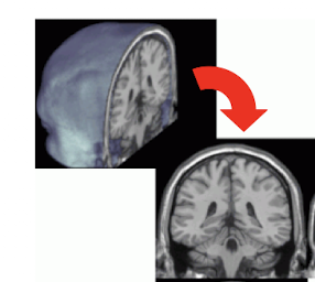 <p>What is this view of the brain?</p>