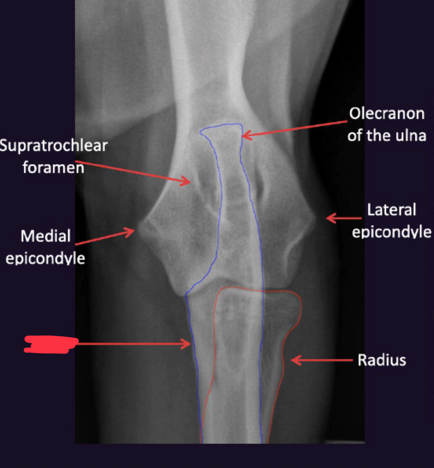 term image