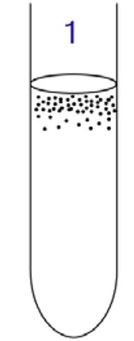 <p>Obligate aerobe </p>