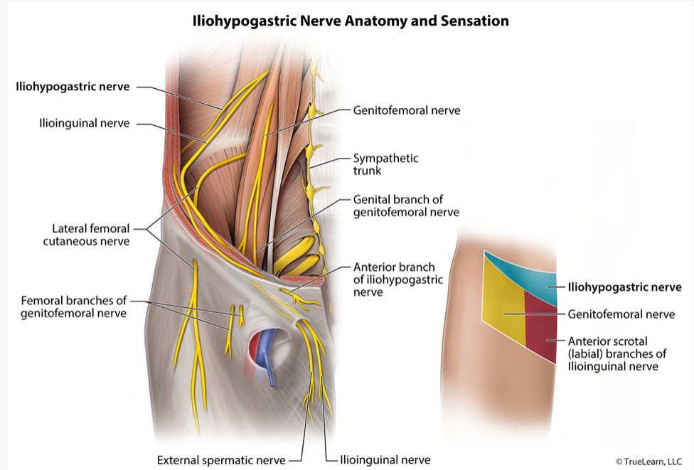 <p>-iliohypogastric nerve</p>