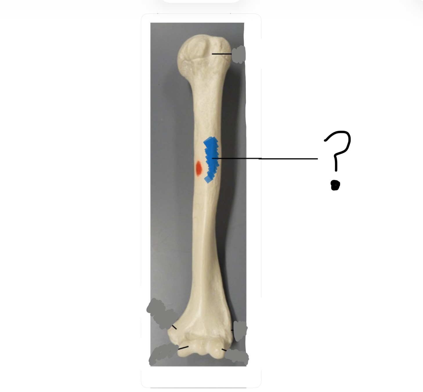<p>Bone name and specific structure</p>
