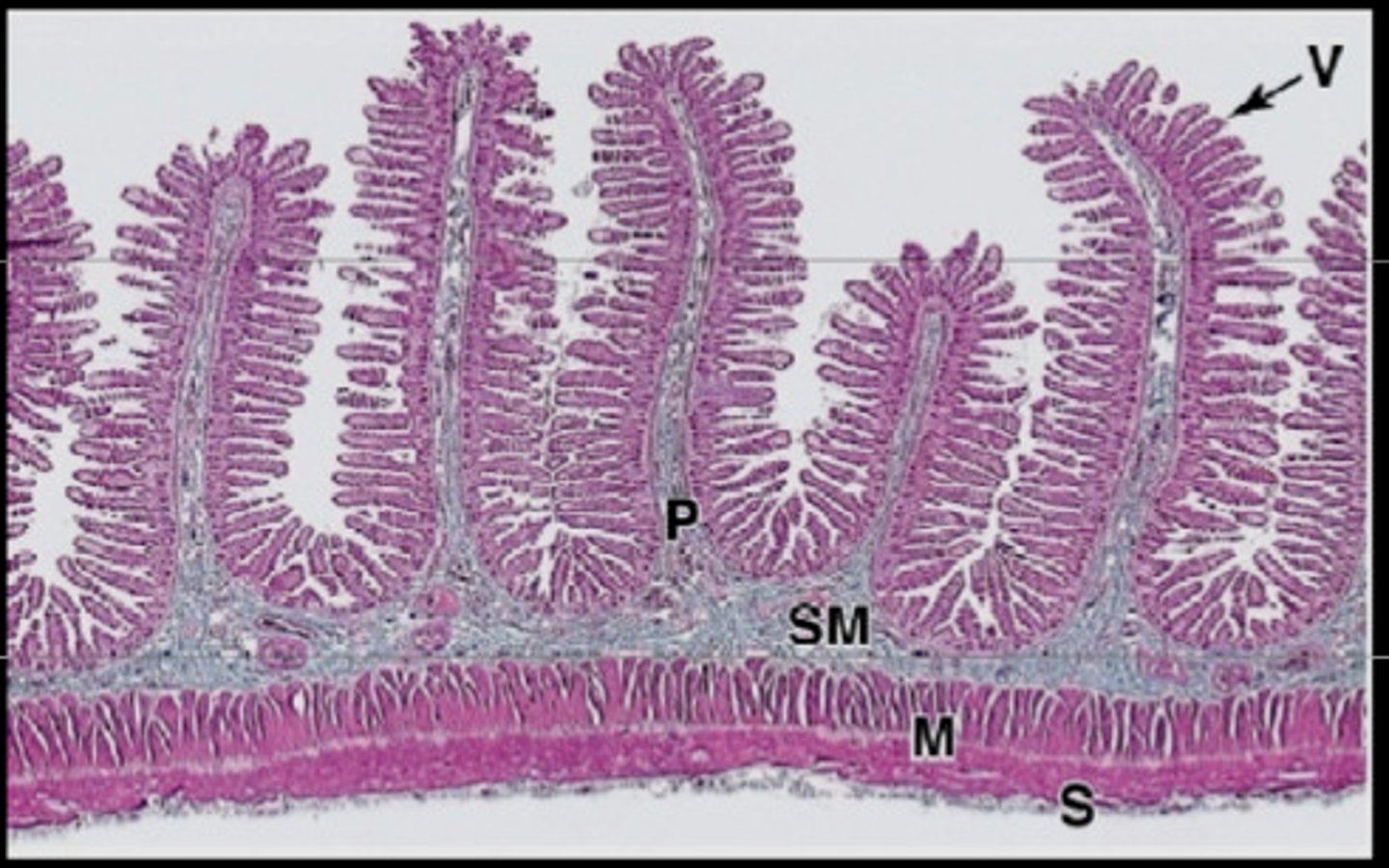 <p>type of structure? {P}</p>